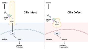 Primary cilia integrity governs TRPV4-mediated NF-κB/COL2 signaling in osteoarthritis pathogenesis