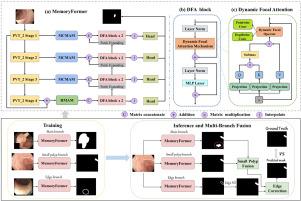 MBT-Polyp: A new Multi-Branch Memory-augmented Transformer for polyp segmentation