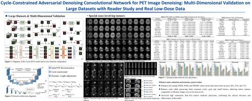 Cycle-constrained adversarial denoising convolutional network for PET image denoising: Multi-dimensional validation on large datasets with reader study and real low-dose data