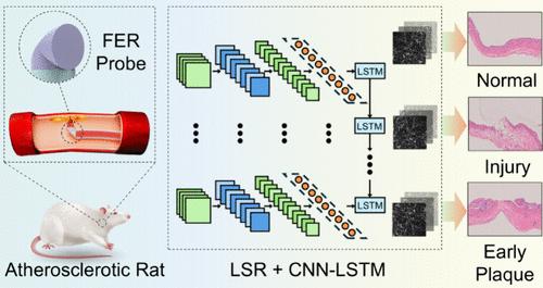 Miniaturized Fiber-End Probe for Laser Speckle Rheology of Atherosclerotic Plaque