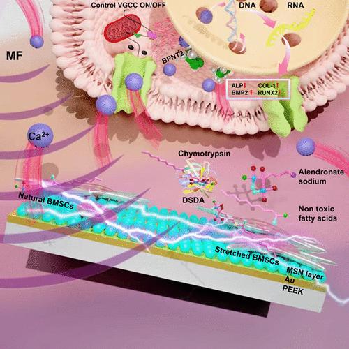 Magnetoelectric Nanoengineered PEEK Implant for Accelerated Osseointegration