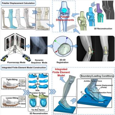 Does shoe cushioning space affect patellofemoral pain risk? A study based on the integrated finite element model