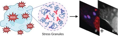 Correlative Raman and immunofluorescence imaging reveals different protein abundance between stress granules induced by oxidative damage
