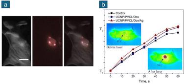 Recent advances in conjugated polymer lanthanide-doped upconversion nanoparticles and their biological applications