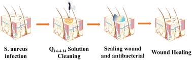 Degradable gemini quaternary ammonium salts for wound sterilization: an antibiotic-free strategy