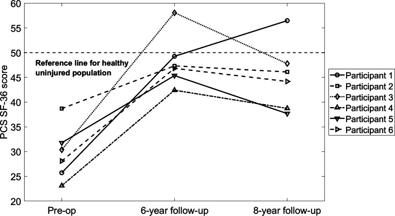 Self-reported health outcomes and medical complications at 6- and 8-year follow-up after direct skeletal fixation in individuals with bilateral transfemoral amputations.