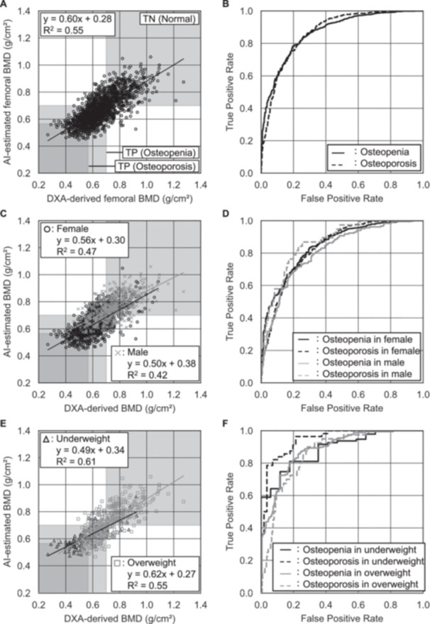 Development of Artificial Intelligence-Assisted Lumbar and Femoral BMD Estimation System Using Anteroposterior Lumbar X-Ray Images.