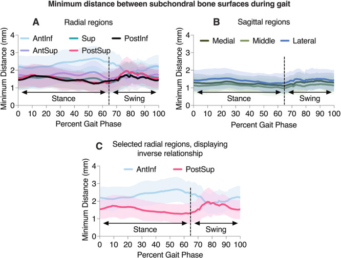 Using Dynamic Joint Space During Physiological Loading to Objectively Measure Hip Stability.
