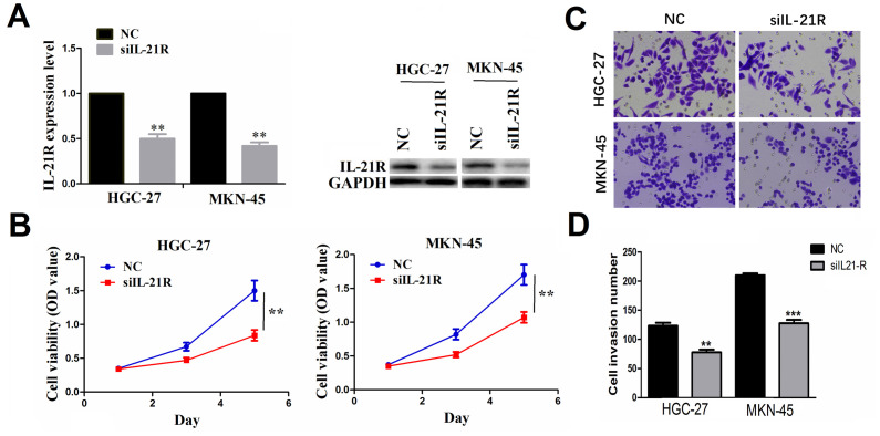 [Corrigendum] IL‑21R functions as an oncogenic factor and is regulated by the lncRNA MALAT1/miR‑125a‑3p axis in gastric cancer.