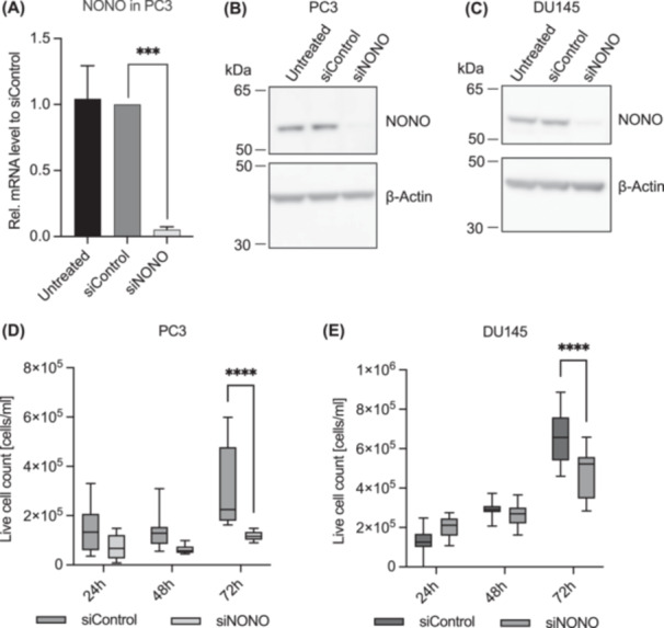 Downregulation of NONO Suppresses Proliferation, Migration, and Invasion in Metastatic Prostate Cancer.