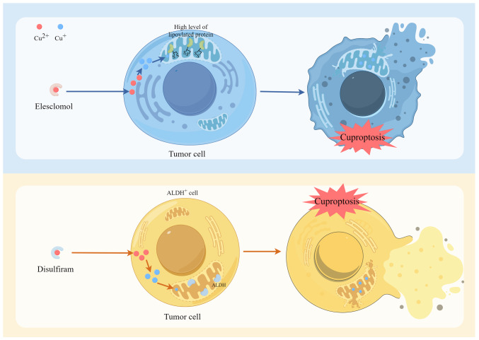 Cuproptosis in prostate cancer: Molecular mechanisms, prognostic biomarkers and therapeutic frontiers of cuproptosis‑related genes (Review).