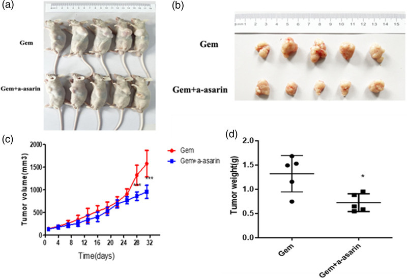 α-Asarone attenuates tumor-associated macrophages-induced gemcitabine resistance in pancreatic carcinoma via the transforming growth factor-beta 1/growth factor independent 1 axis.