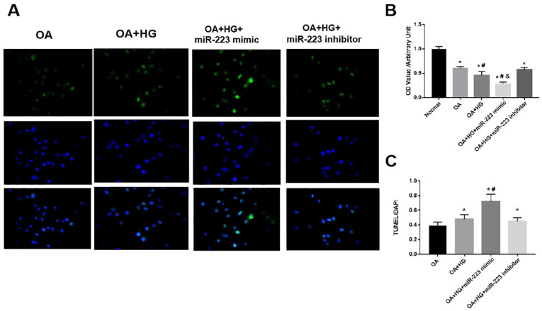 Micro-223 Promotes Diabetic Osteoarthritis Progression by Regulating Cartilage Degeneration and Subchondral Bone Remodeling.
