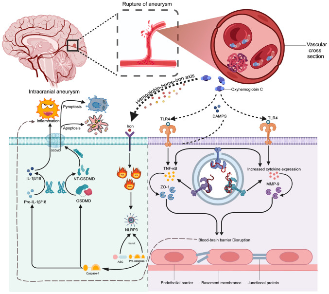 Mechanisms and interventions in aneurysmal subarachnoid hemorrhage: Unraveling the role of inflammatory responses and cell death in early brain injury (Review).