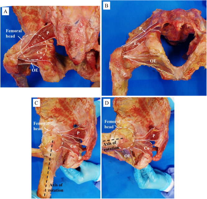 Comparison of External Rotation Torque of Short External Rotator Muscles in Hip Flexion Position.