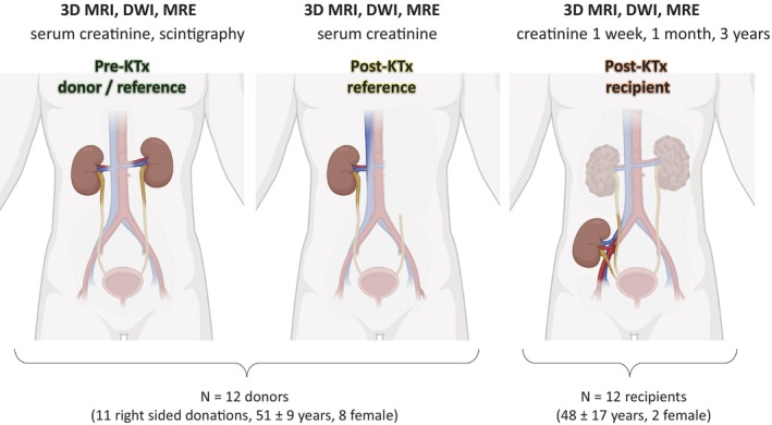 Association of In Vivo Kidney Stiffness Measured by Multifrequency MR Elastography and Long-Term Renal Function in Transplant Recipients and Living Donors.