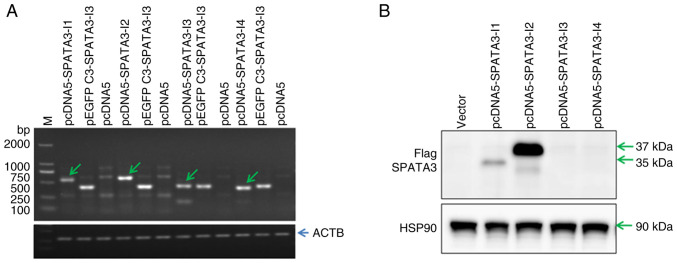 Roles of human SPATA3 in cell proliferation and expression pattern of <i>Spata3</i> in mouse testis.