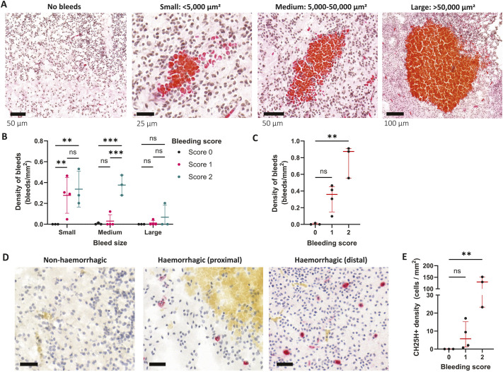 The role of 25-hydroxycholesterol in the pathophysiology of brain vessel dysfunction associated with infection and cholesterol dysregulation.