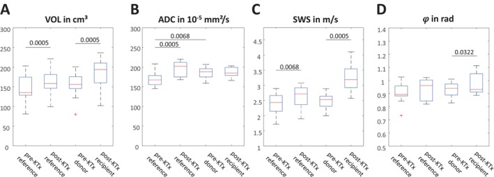 Association of In Vivo Kidney Stiffness Measured by Multifrequency MR Elastography and Long-Term Renal Function in Transplant Recipients and Living Donors.