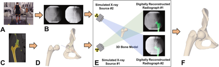 Using Dynamic Joint Space During Physiological Loading to Objectively Measure Hip Stability.