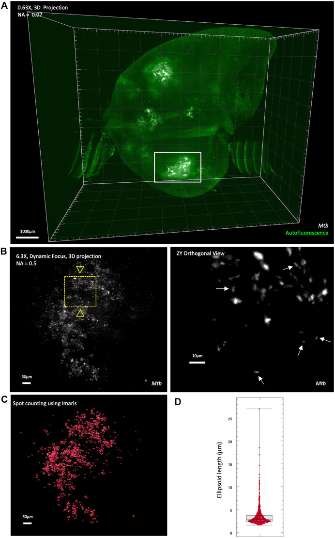 Correlative 3D imaging method for analysing lesion architecture in susceptible mice infected with Mycobacterium tuberculosis.
