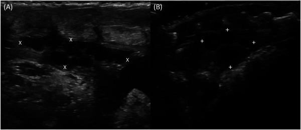 Comparative Sonographic Studies of the Urogenital Tract in Lizards.