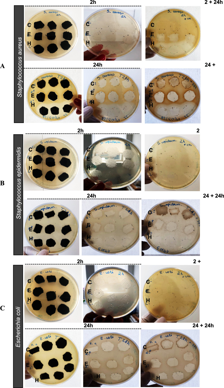 Boosting textiles with plant extracts: an advanced sustainable antimicrobial innovation for direct skin applications.