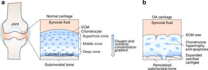 The impact of mitochondrial dysfunction on osteoarthritis cartilage: current insights and emerging mitochondria-targeted therapies