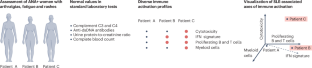 Immune-cell profiling to guide stratification and treatment of patients with rheumatic diseases