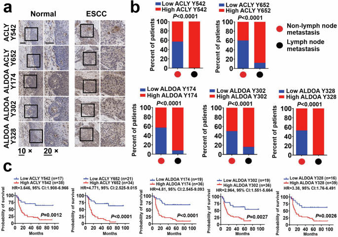 Focal adhesion kinase/Src family kinase axis-mediated tyrosine phosphorylation of metabolic enzymes facilitates tumor metastasis