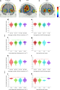 Quantifying the impact of hair and skin characteristics on fNIRS signal quality for enhanced inclusivity