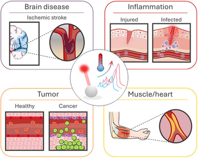 Optical Nanothermometry as a Diagnostic Tool for Diseases: Physical Principles, Challenges, and Limitations