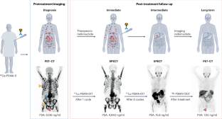 The molecular blueprint of targeted radionuclide therapy