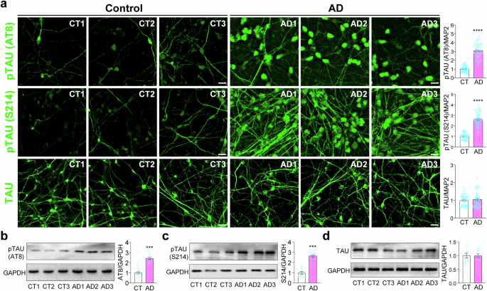 Elevated SGK1 increases Tau phosphorylation and microtubule instability in Alzheimer’s patient-derived cortical neurons