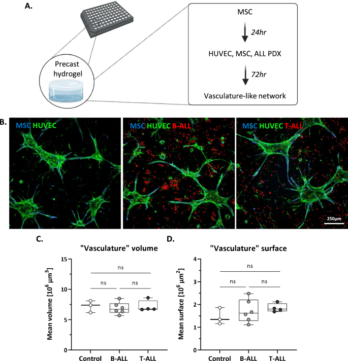 A three-dimensional ex vivo model recapitulates in vivo features and drug resistance phenotypes in childhood acute lymphoblastic leukemia