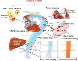 Glycoursodeoxycholic acid 3 sulfate sodium links hemodynamics and bile acid metabolism in aortic stenosis