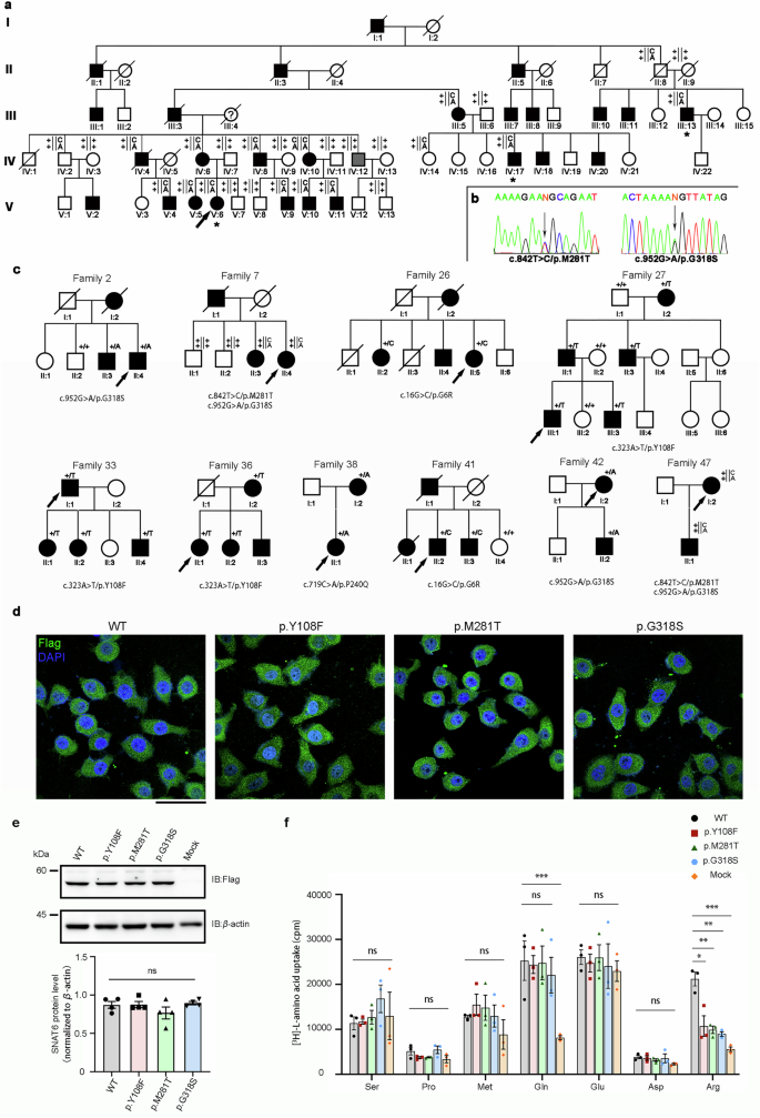 Loss-of-function variations in solute carrier family 38 member 6 are associated with essential tremor