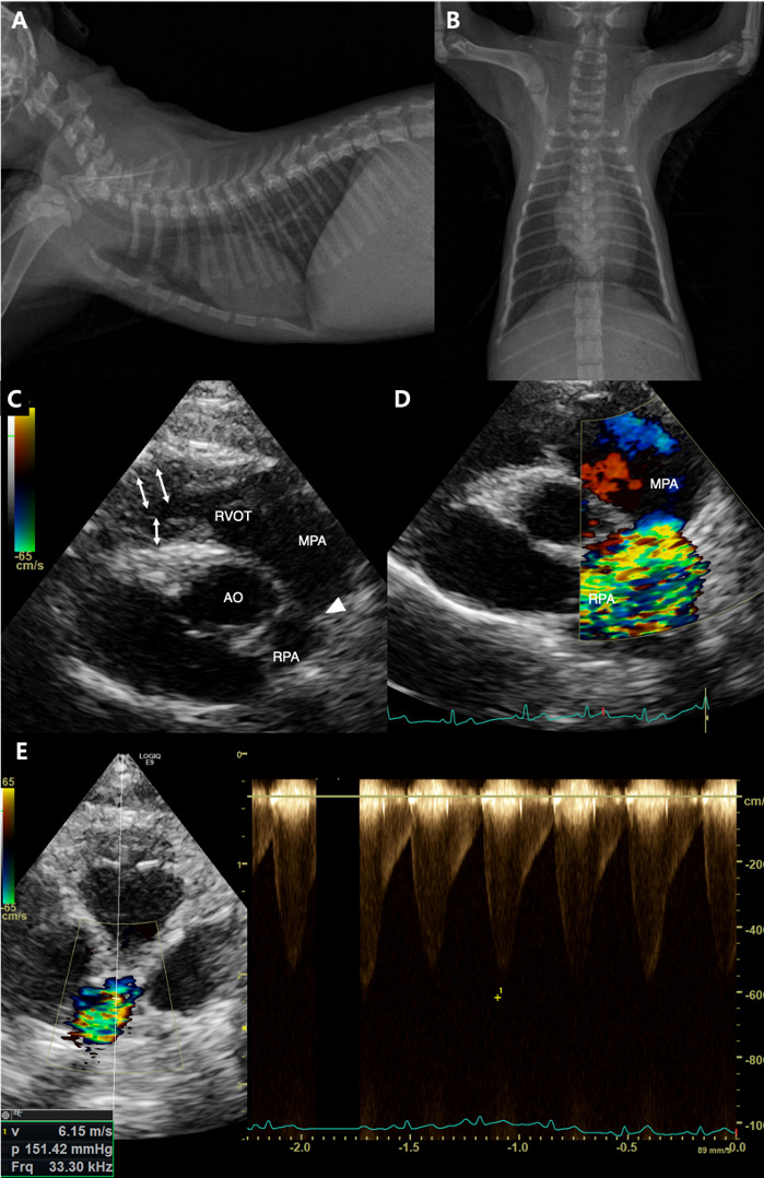 Successful balloon angioplasty of right pulmonary coarctation with left pulmonary artery interruption in a cat: a long-term outcome follow-up case report.