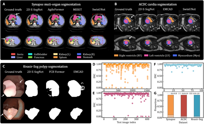E-SegNet: E-Shaped Structure Networks for Accurate 2D and 3D Medical Image Segmentation.