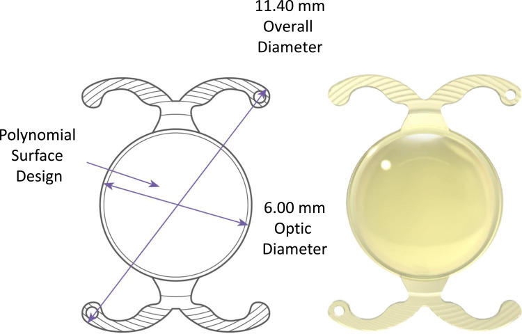 Clinical Outcomes of a Multicenter Study Following Implantation of an Isofocal Optic IOL with Double C-Loop Haptics.