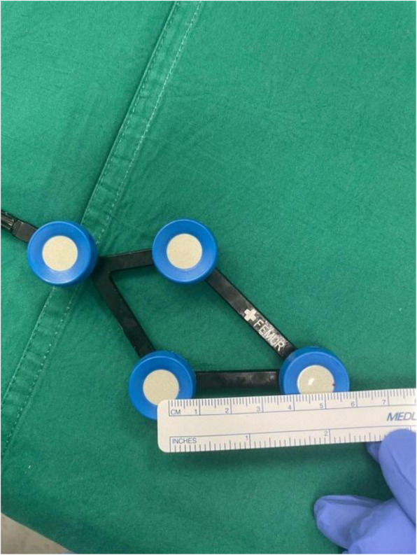 Novel all-intra-incisional pin placement technique in robotic total knee arthroplasty: a safer alternative.