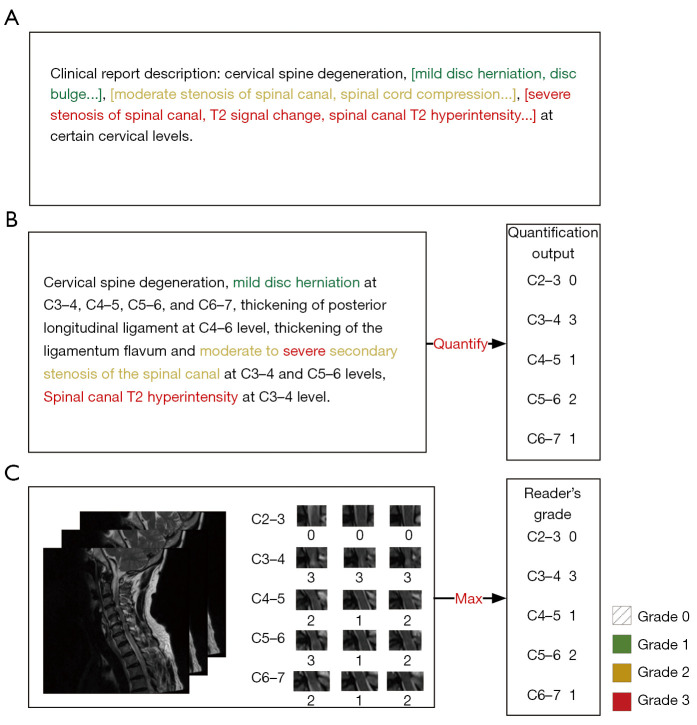 Feasibility of fully automatic assessment of cervical canal stenosis using MRI via deep learning.