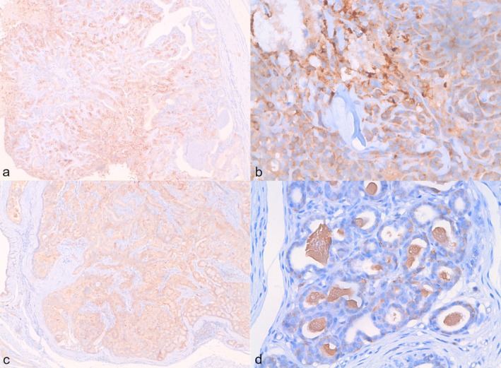 Transferrin Receptor-1: Expression in Canine Mammary Tumours and In Vitro Therapeutic Applications.