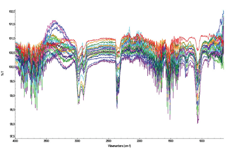 Non-invasive diagnosis of endometrioma through cervical swabs using Fourier transform infrared spectroscopy.