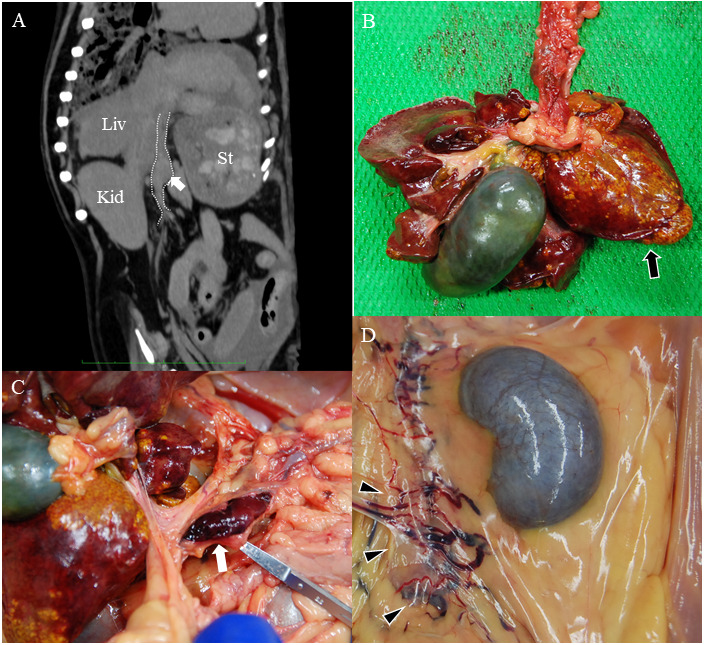 Treatment of portal vein thrombosis with rivaroxaban in an American cocker spaniel with chronic hepatitis: a case report.