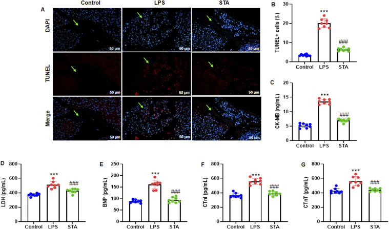 Stachydrine Alleviates Sepsis-Induced Cardiomyopathy by Inhibiting Ferroptosis via Regulating SIRT1/GPX4 Pathway.