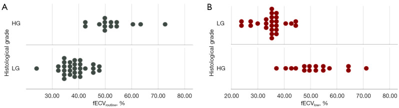 Extracellular volume fraction based on dual-layer spectral computed tomography in assessment of gastric cancer: feasibility analysis of low-dose equilibrium phase scanning.