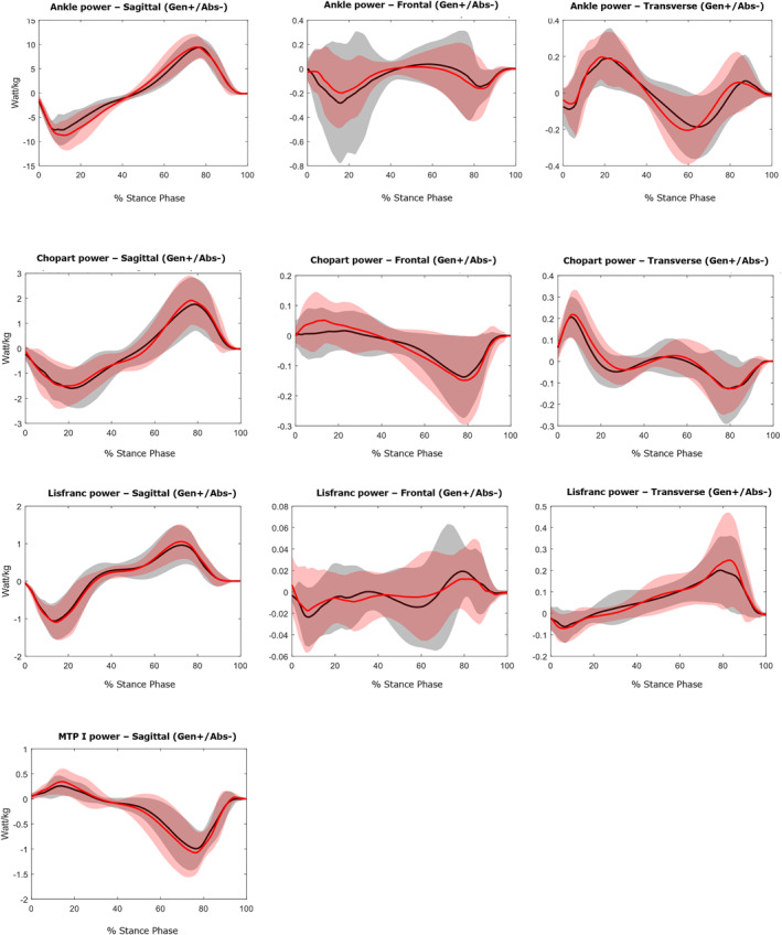 Single Leg Drop and Hop: Insight Into Multisegment Foot Kinematics, Kinetics and the Role of Visual Focus in Healthy Young Adult Males.