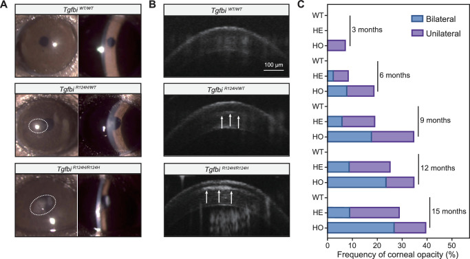 A Novel Mouse Model of Granular Corneal Dystrophy Type II Reveals Impaired Autophagy and Recapitulates Human Pathogenesis.