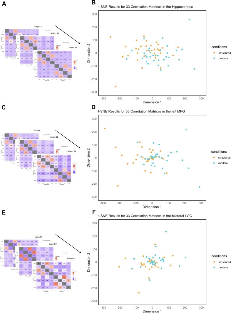 Neural representations of visual statistical learning based on temporal duration.